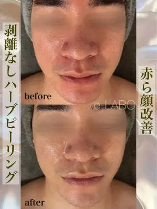 e-LABO こいずみのエステ・リラクイメージ