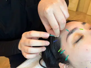 美容鍼/ヘッドスパ/ 💎さかもとのエステ・リラクイメージ