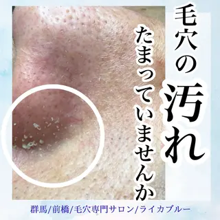 毛穴専門サロン ライカブルーのエステ・リラクイメージ