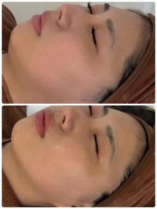 FLEUR🫧 フェイシャルのエステ・リラクイメージ