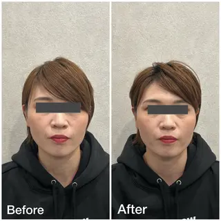 小顔矯正・骨盤矯正 FLOW鍼灸整体院のエステ・リラクイメージ