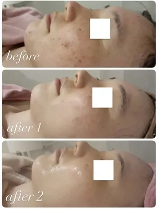 RAY Beauty エステ　一宮店のエステ・リラクイメージ