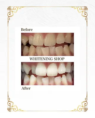 ホワイトニングショップ静岡葵区店所属・ホワイトニング ショップ葵区静岡駅店のその他イメージ