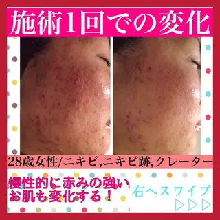 ミディアム カラー パーマ ヘアアレンジ メンズ キッズ ネイル マツエク・マツパ ニキビ・肌質改善専門 ♡人生が変わるサロンのエステ・リラクイメージ