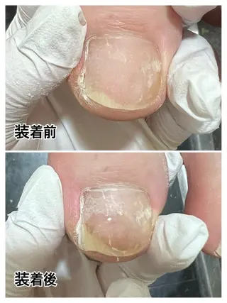 ネイル 巻き爪補正店 堺東店のネイルデザイン