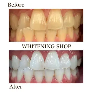 ホワイトニングショップ伊丹店所属・ホワイトニング ショップ伊丹店のその他イメージ