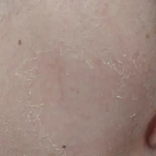 小顔と腸の専門店 ラクーラビューティのエステ・リラクイメージ