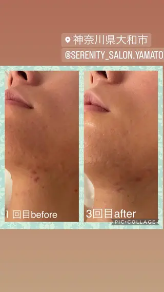 Serenity salonのエステ・リラクイメージ