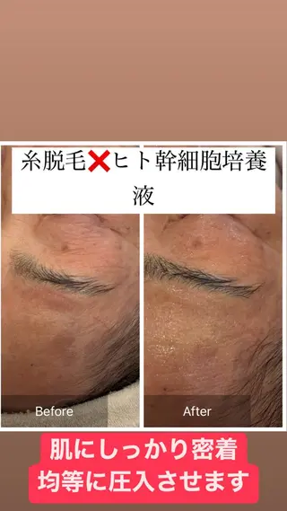 産毛専門店 Bittoのエステ・リラクイメージ