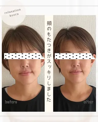 小顔矯正& 慢性肩こり腰痛改善店のエステ・リラクイメージ