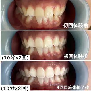 ホワイトニング専門店 Hi-Whiteのその他イメージ