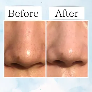 Beauty SalonEclatのエステ・リラクイメージ