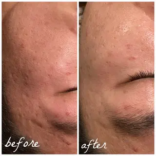 メンズ メナード岐阜市茜部 杉浦のエステ・リラクイメージ