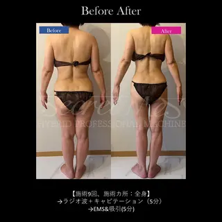 Bellvie beauty salon所属・Bellvie かすみのエステ・リラクイメージ