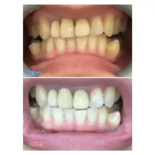 MBEAUTYSALON 千葉店・京成大久保所属・Melty 輝のその他イメージ