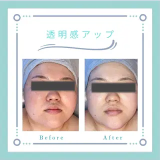 フェイシャルエステLe・Ciel所属・Le・Ciel フェイシャル&ボディのエステ・リラクイメージ