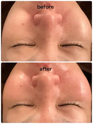 クリニカルサロン ANISHのエステ・リラクイメージ