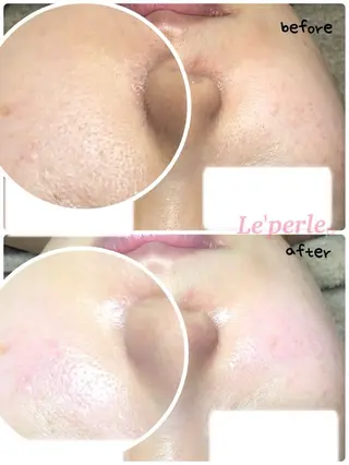 Le'perle｡所属・Le'perle｡ Kyokaのエステ・リラクイメージ