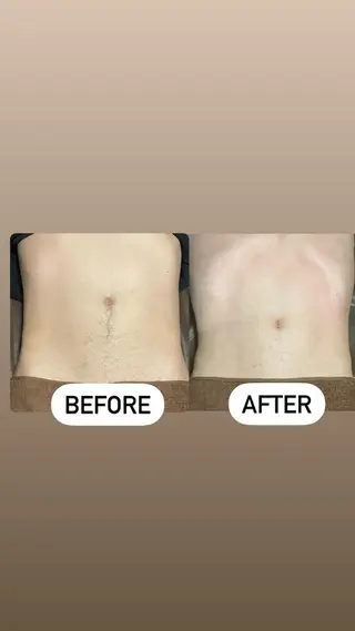 メンズ眉毛ITSUK Iメンズ専門　新宿の眉毛・アイブロウイメージ