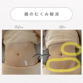 美腸活･黄土よもぎ蒸しサロン【calme】所属・美腸活･黄土よもぎ 蒸しサロン【カルム】のエステ・リラクイメージ