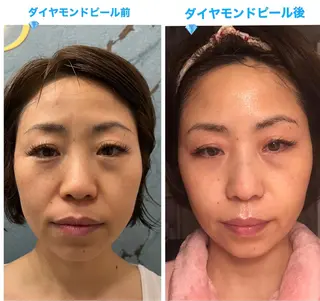 リラクゼーション ルナのエステ・リラクイメージ