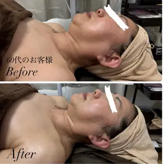 Total Beauty Salon Vi's CLUB by BINEL所属・Vi's CLUB KOTONOのエステ・リラクイメージ