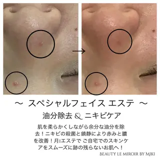 ビューティー ミロワールのエステ・リラクイメージ