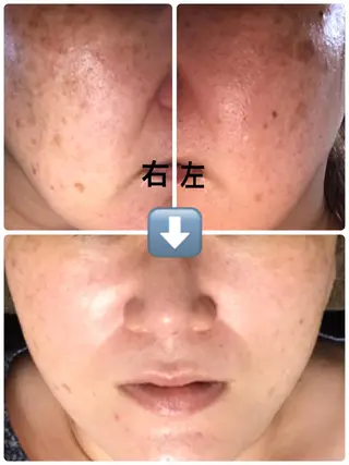 首・肩こり専門リンパ ケアサロンSENKAのエステ・リラクイメージ