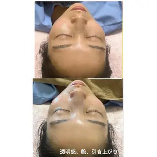 美容鍼灸サロン mahoroba院長のエステ・リラクイメージ