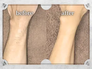 都度払い脱毛 Lino柏/Moneのエステ・リラクイメージ