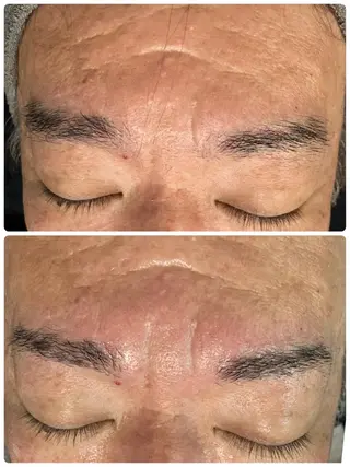 メンズ アイブロウ メンズフェイシャル アイブロウ・ルースのエステ・リラクイメージ