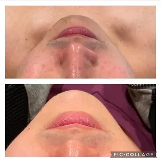 メンズ マドンナ 富士店のエステ・リラクイメージ