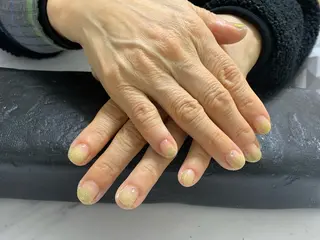 ネイル しょう えんきんのネイルデザイン