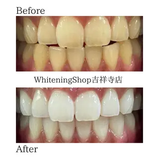 ホワイトニング ショップ吉祥寺店のエステ・リラクイメージ