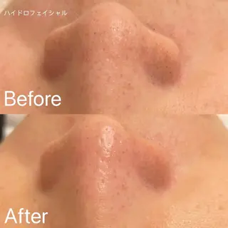 アイラッシュ&エステサロンLinda西宮所属・小顔&毛穴・肌質改善 LINDA西宮 AIのエステ・リラクイメージ