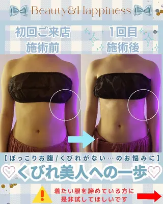 痩身ハーブピーリング 筋膜リリース☆B&Hのエステ・リラクイメージ