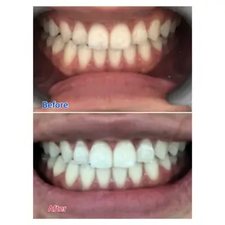 MBEAUTYSALON 千葉店・京成大久保所属・Melty 輝のその他イメージ