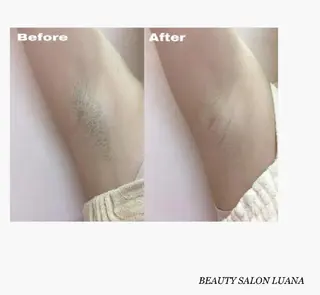 脱毛・小顔専門サロンLUANA所属・脱毛&シェービング 専門店　平岡のその他イメージ