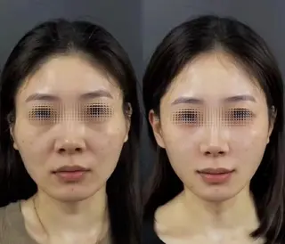 aliaハイフ&水光ジェットサロン所属・aliaハーブ水光店 エステティシャン募集のエステ・リラクイメージ