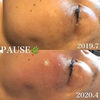 浜野 恵美のエステ・リラクイメージ