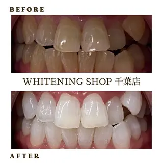メンズ ホワイトニング ショップ千葉店のその他イメージ