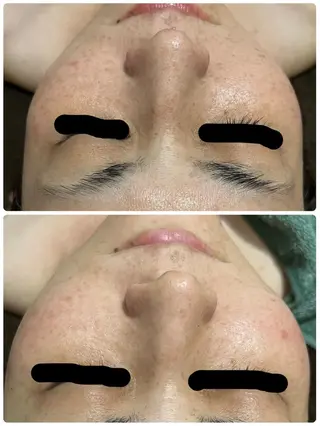 SALON BioBioのエステ・リラクイメージ