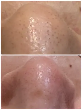 肌質改善◇結果重視 美麗-MIREI-のマツエク・マツパデザイン