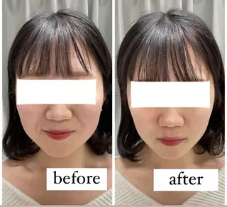 ENCHANT 脱毛.小顔.毛穴のエステ・リラクイメージ