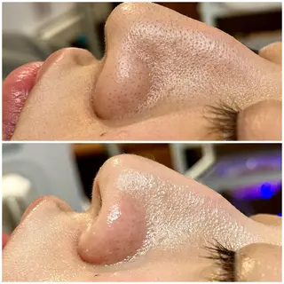 Lokahi所属・脱毛サロン Lokahiのエステ・リラクイメージ