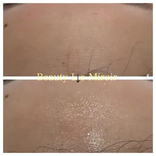 ビューティー ミロワールのエステ・リラクイメージ