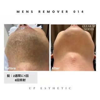 メンズ ウプエステティック所属・韓国肌管理 ウプエステティックのエステ・リラクイメージ