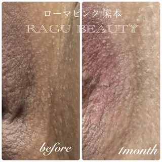 RAGU BEAUTY所属・原口 彩子のエステ・リラクイメージ