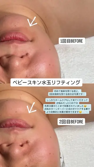 韓国肌管理🫧LDM 🫧Junnaのエステ・リラクイメージ