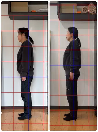 KAKERU 鍼灸整体【慢性痛】のエステ・リラクイメージ